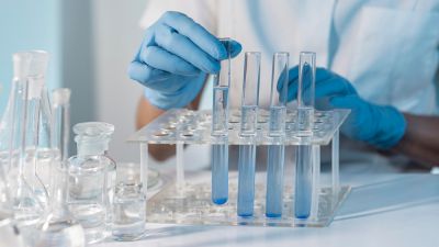 Exames laboratoriais